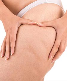 C-Lipolysis with Adv R